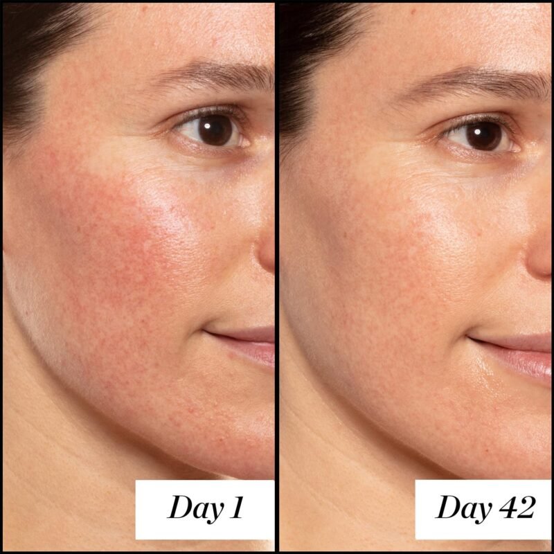 Sunday Riley A+ High-Dose Anti Aging Retinol Serum - Image 5