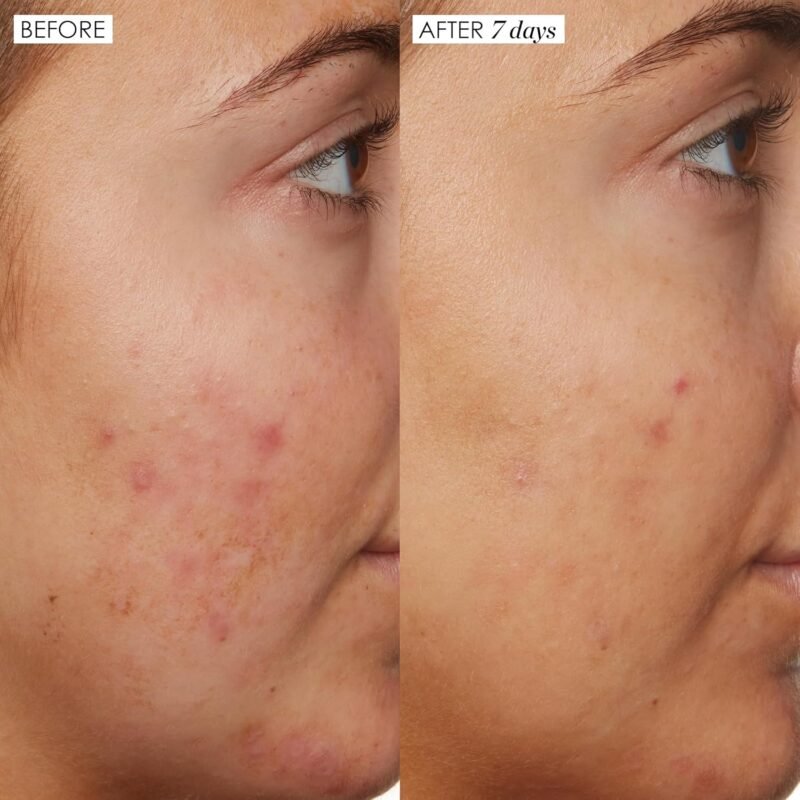 Sunday Riley B3 Nice 10% Niacinamide Serum 1.0oz - Image 2