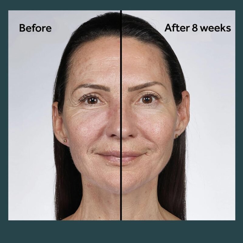 No7 Future Renew Damage Reversal Night Cream - Hydrating Face Moisturizer & Firming Cream to Reverse Visible Signs of Skin Damage - Dermatologist Approved and Suitable for Sensitive Skin (1.69 Fl Oz) - Image 5