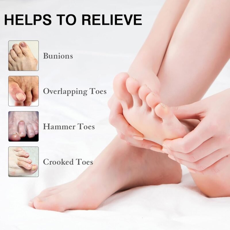 Toe Spacers for Women and Men, Toe Separators for Pedicure, Bunion Corrector, Hammer Toe Straightener, Plantar Fasciitis, Toe Spreaders for Foot Pain Relief and Foot Health. (Black) - Image 2