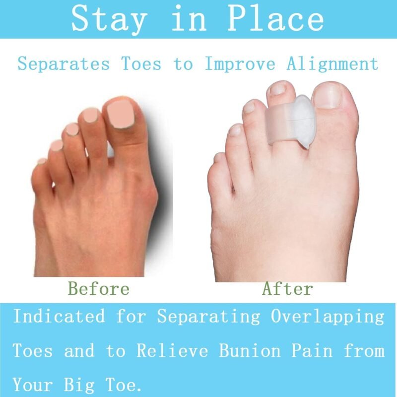 Pack of 12 Gel Toe Separator, (1/4" Thick) Big Toe Spacers, Single Loop Toe Spreader for Bunions, Overlapping Toe, Corrector and Spacer (Clear) - Image 4