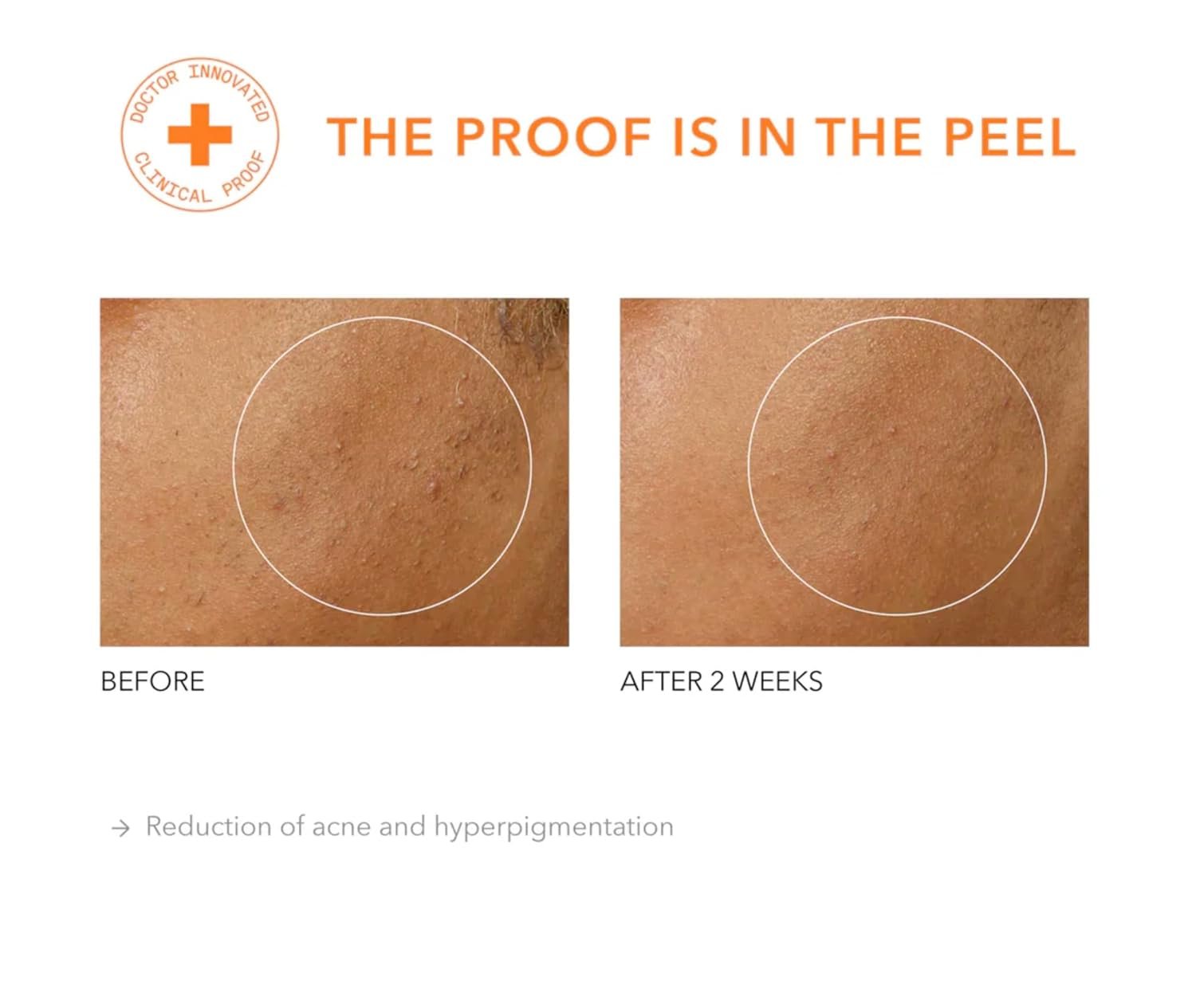 Dr Dennis Gross Alpha Beta Universal Daily Peel: for Uneven Tone or Texture and Fine Lines or Enlarged Pores, (5 Treatments) - Image 7