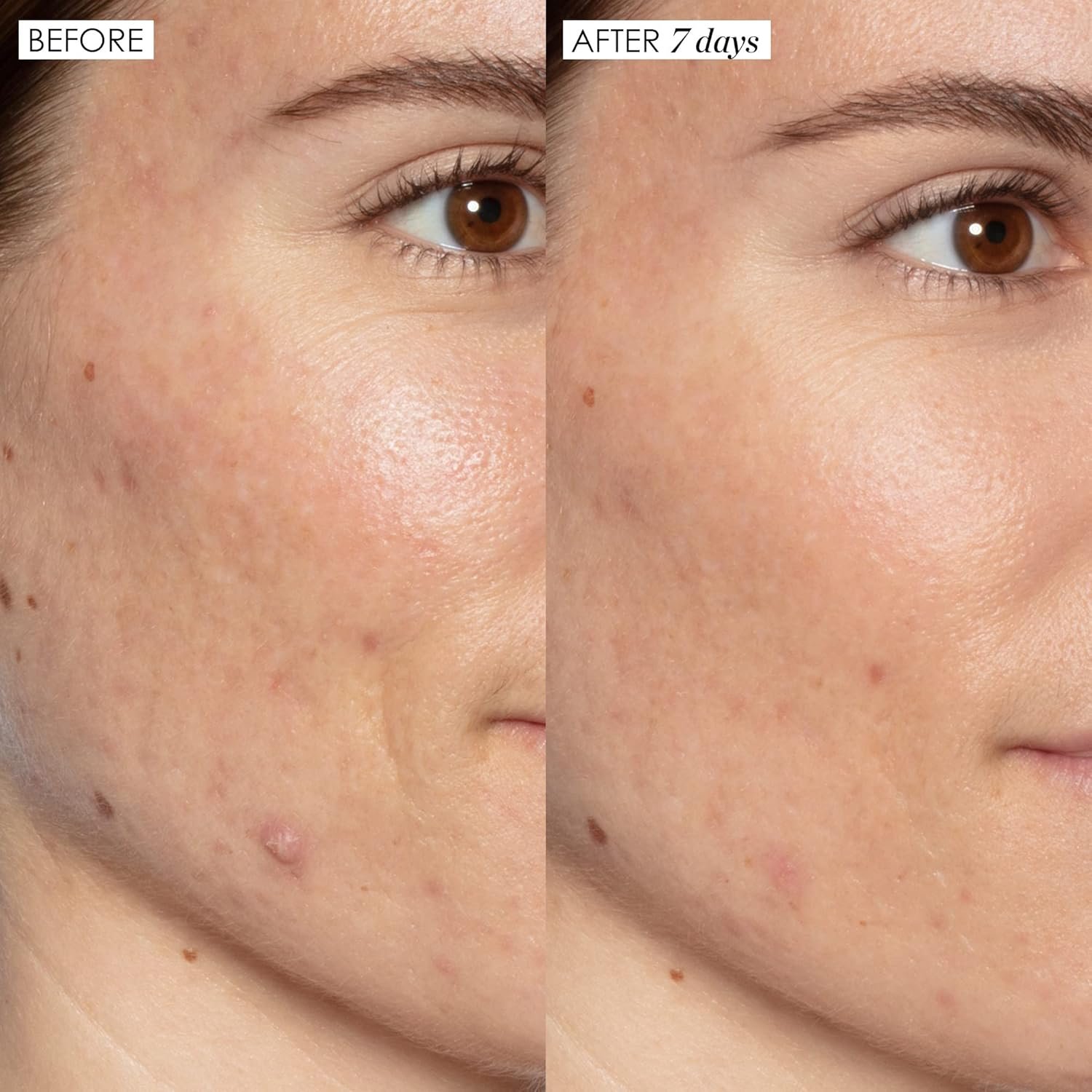 Sunday Riley Good Genes All-in-One Lactic Acid Treatment Face Serum - Image 4