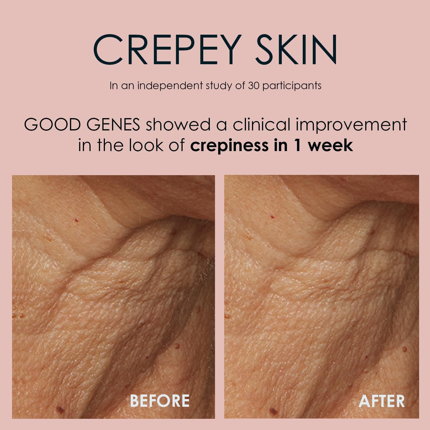 Sunday Riley Good Genes All-in-One Lactic Acid Treatment Face Serum - Image 6