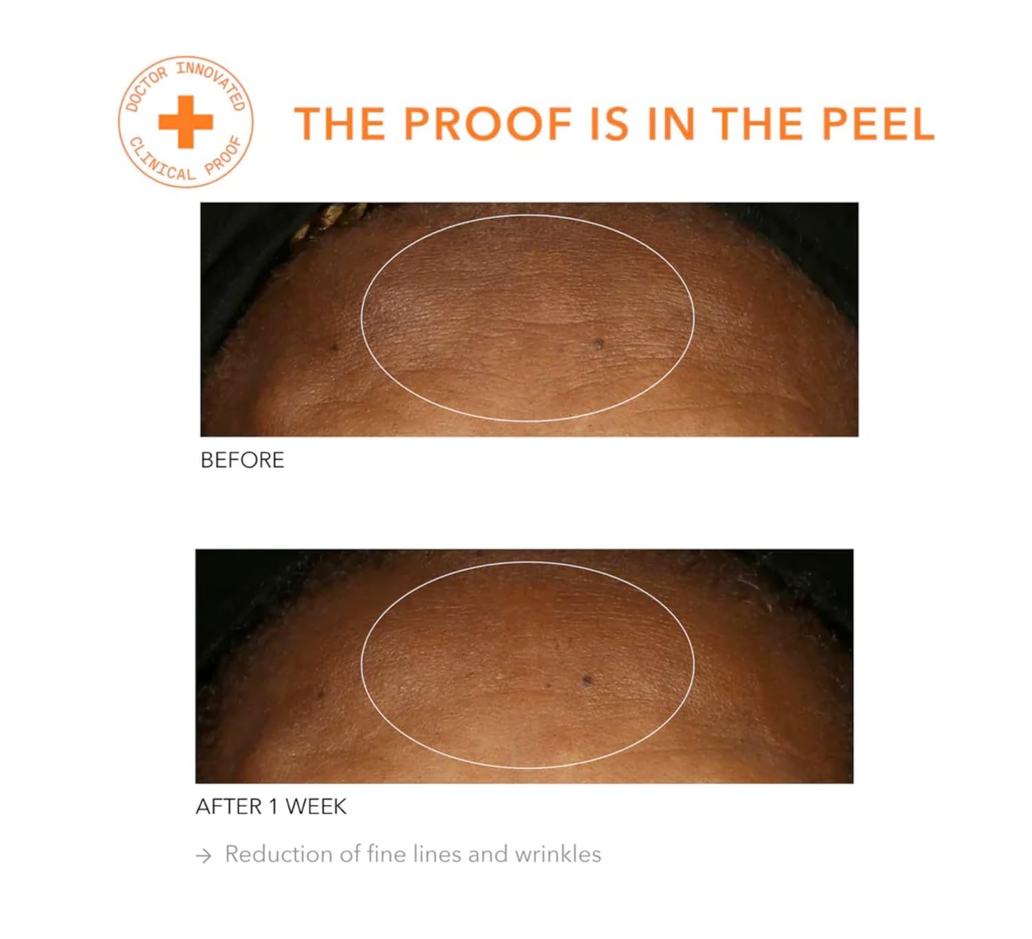 Dr Dennis Gross Alpha Beta Universal Daily Peel: for Uneven Tone or Texture and Fine Lines or Enlarged Pores, (5 Treatments) - Image 8
