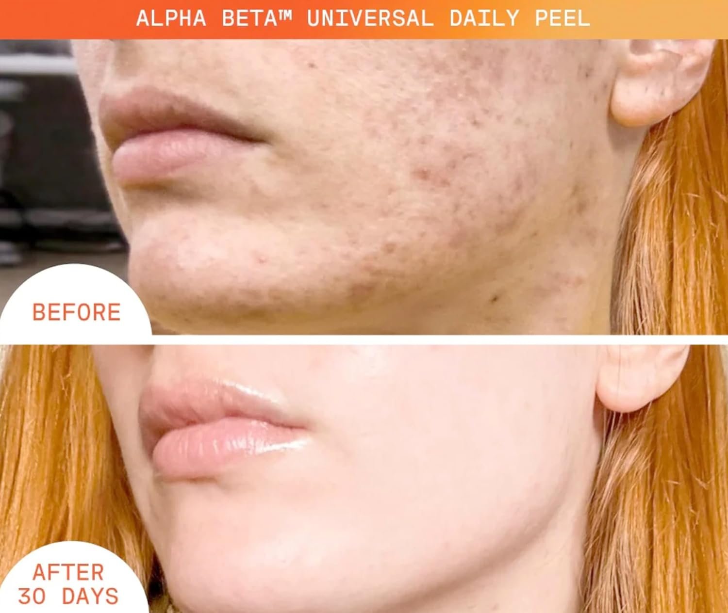 Dr Dennis Gross Alpha Beta Universal Daily Peel: for Uneven Tone or Texture and Fine Lines or Enlarged Pores, (5 Treatments) - Image 6