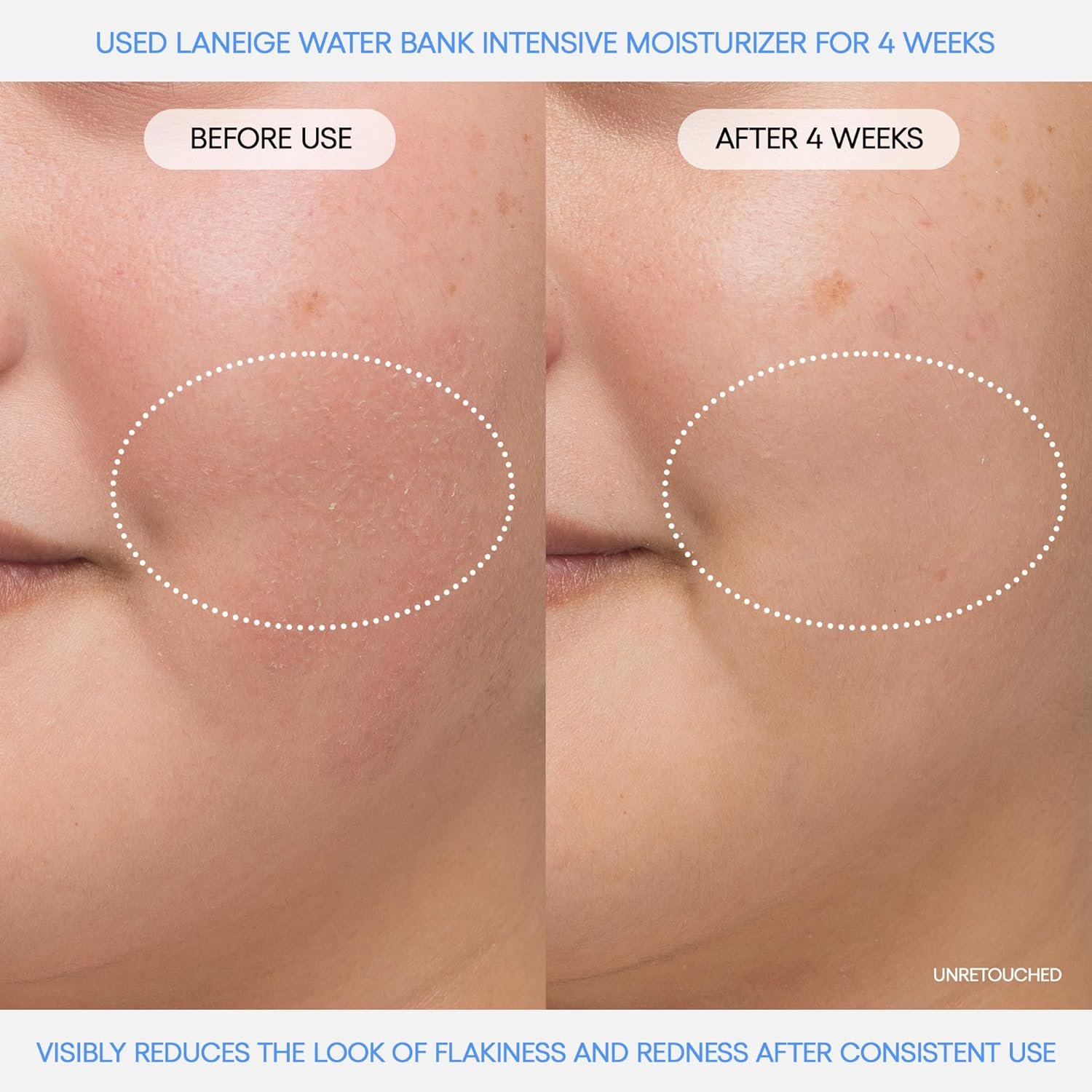 LANEIGE Water Bank Blue Hyaluronic Intensive Moisturizer: Hydrating Face Cream for Extra Dry Skin with Squalane & Peptide for Skin Barrier Support, Dermatologist-Tested - Image 3