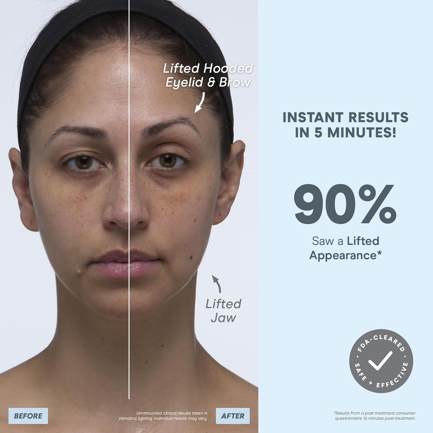 NuFACE MINI+ Microcurrent Facial Device Ultimate Uplift Kit - Brilliant White Face Sculpting & Contouring Device with Aqua Gel, Power Patches, Prep-N-Glow Skin Care Wipes & Luxe Gift Box - Image 6