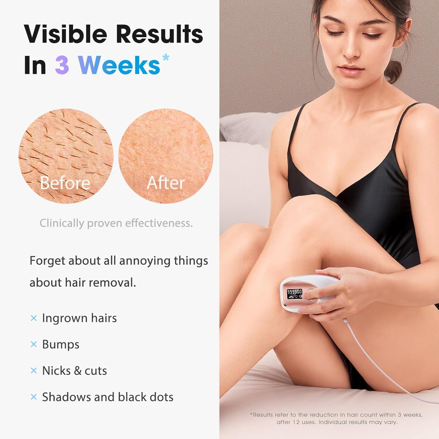 IPL Laser Hair Removal Device for Women & Men - Home 45°F Ice-Cooling Contact for Painless & Long-Lasting Results, 86% Hair Reduction in 3 Weeks for Full Body & Bikini Line, Rose Gold - Image 2