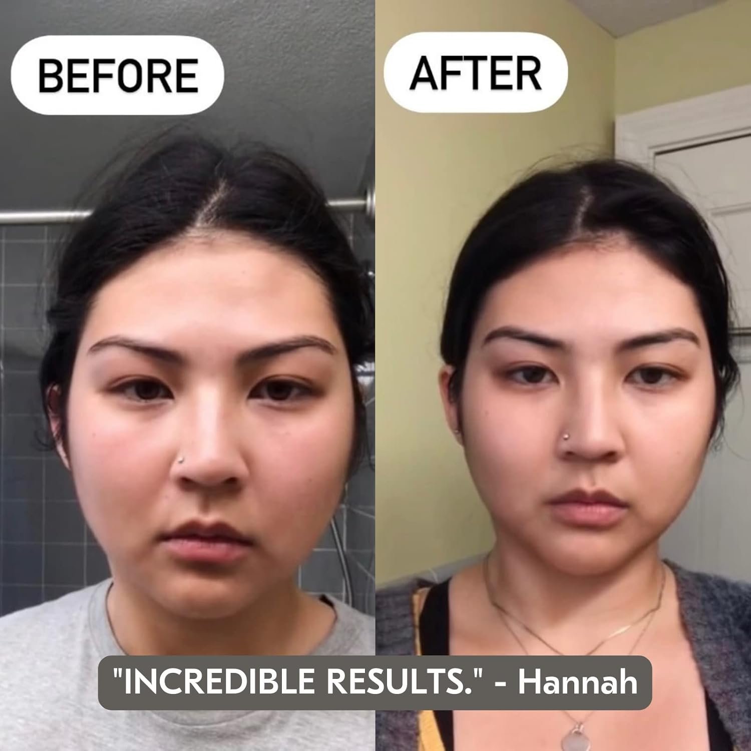 Mount Lai Rose Quartz Gua Sha Facial Tools, Pink Quartz Gua Sha Facial Tools Set and Roller, Guasha Tool for Face to Relieve Muscle Tension and Reduce Puffiness, Anti Aging Skin Care Sets for Women - Image 4